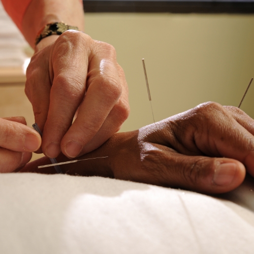 acupuncture-Christopher-Horsford-Physical-Therapy-Shirley-NY-1