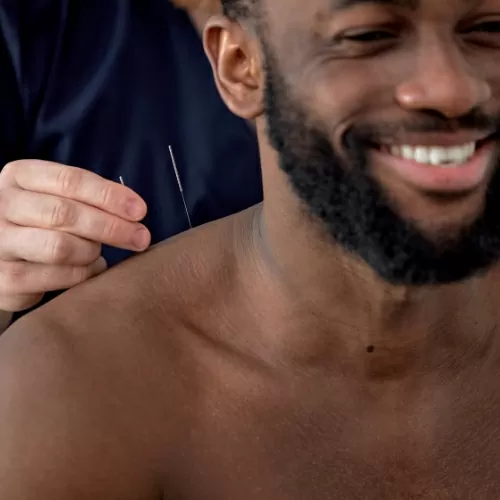 acupuncture-Christopher-Horsford-Physical-Therapy-Shirley-NY